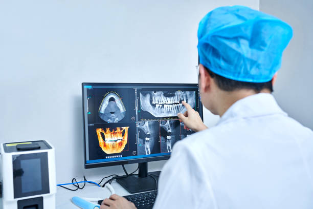 Best Emergency Wisdom Teeth Removal in Fort Denaud, FL